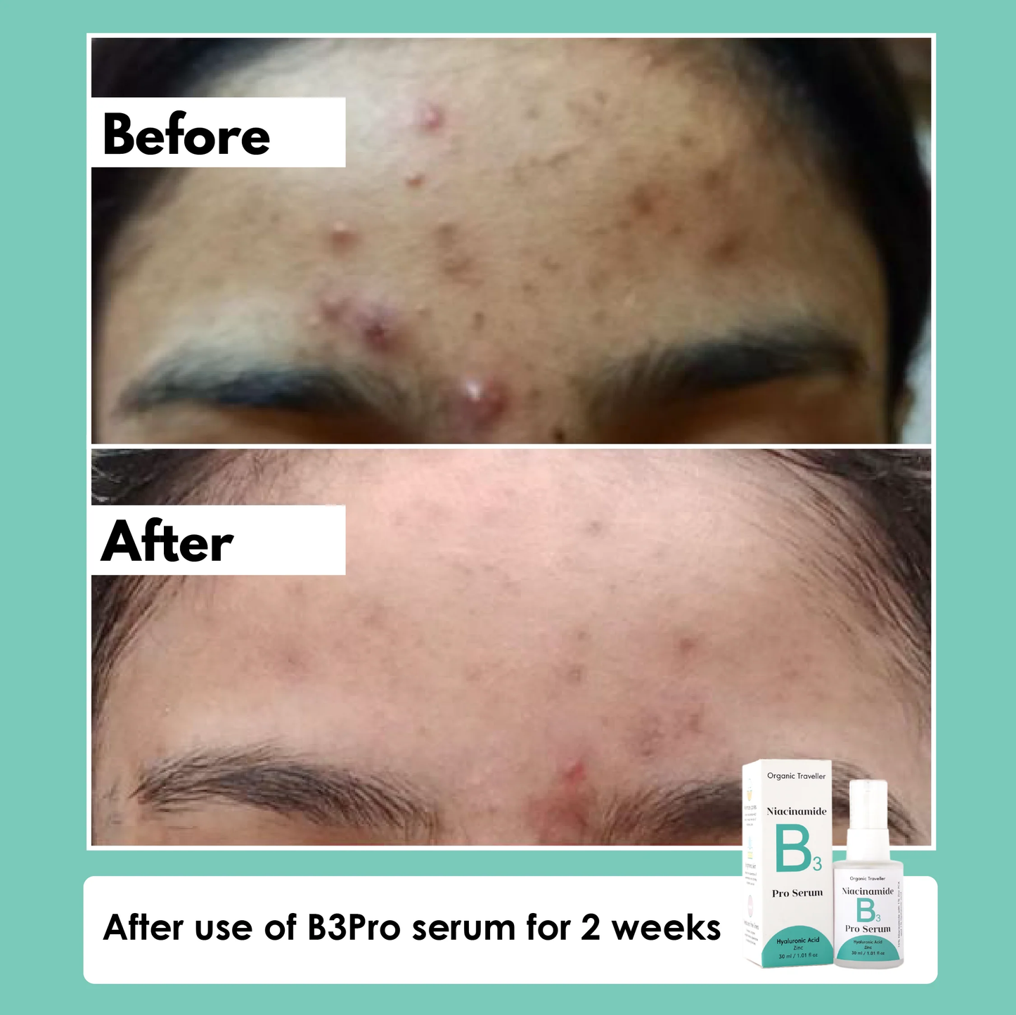 B3 PRO: Pore erasing serum