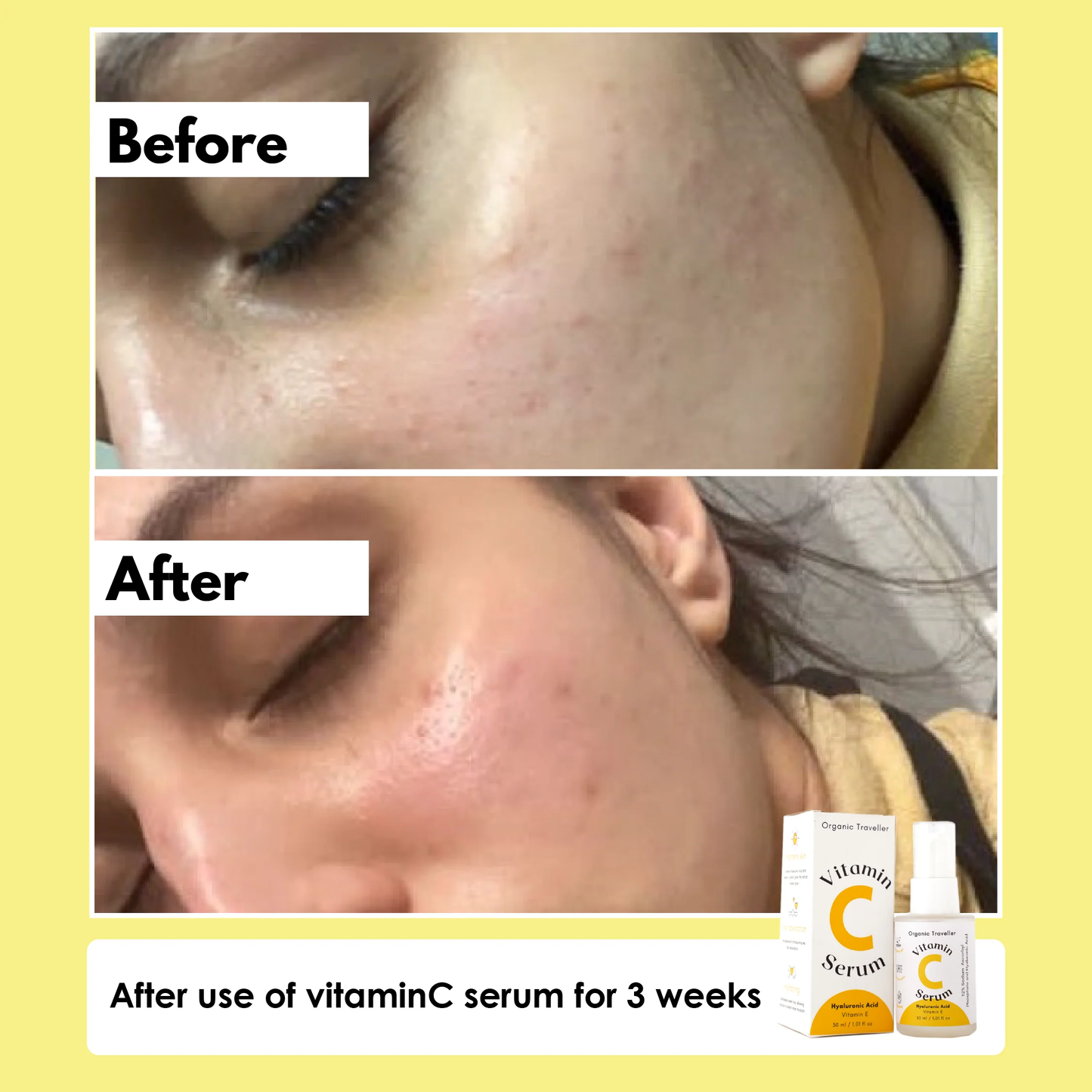 Super C: Vitamin C serum